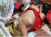 Siapa Peduli, Merianti Warga Payakumbuh 2 Tahun Terbaring Lemah Butuh Bantuan